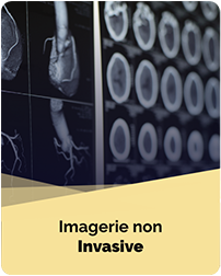 Imagerie Non Invasive