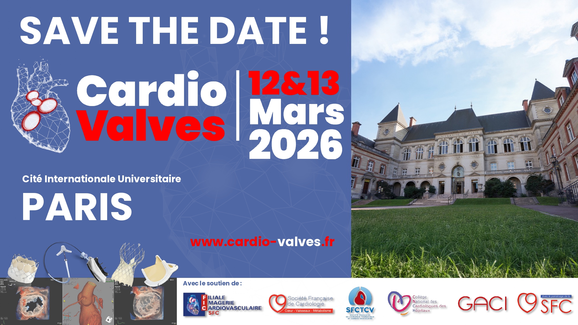 Cardio Valves 12&13 Mars 2026 - Paris